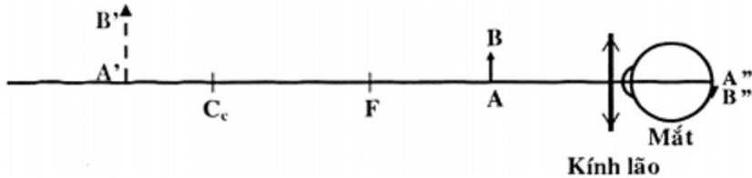 mắt cận mắt lão mắt cận mắt lão